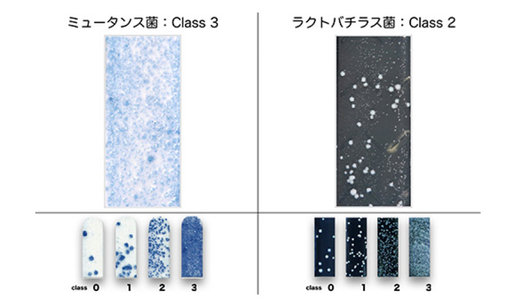 唾液量と虫歯菌数の測定